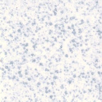 Steinzeug 20x20mm - Puntos-Blau