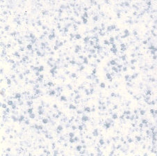 Steinzeug 20x20mm - Puntos-Blau