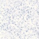 Steinzeug 20x20mm - Puntos-Blau